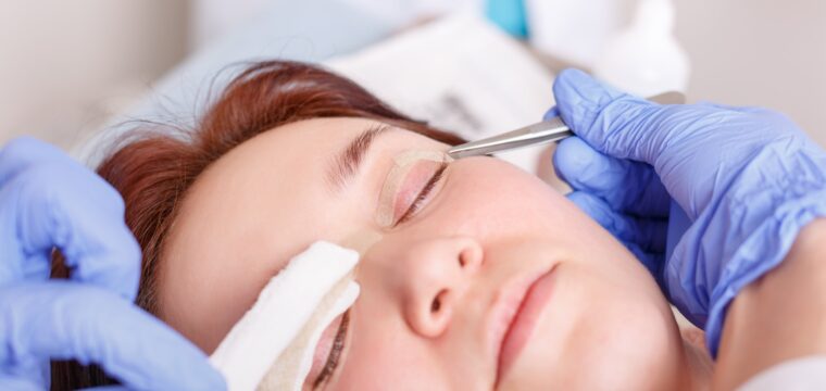 Are you considering eyelid surgery