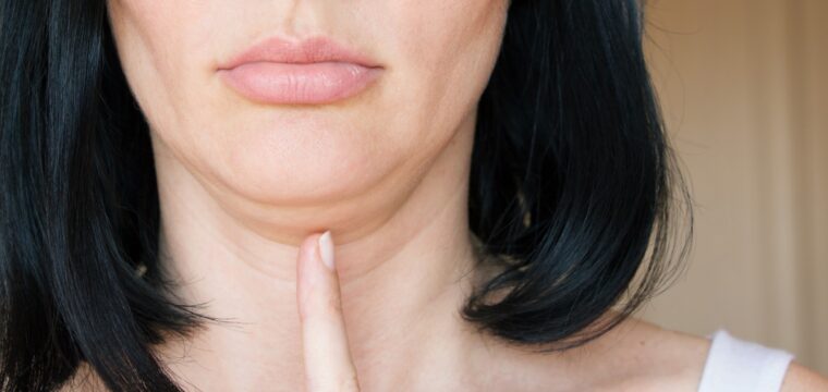 Erase Your Double Chin Without Surgery Using Kybella® Injections
