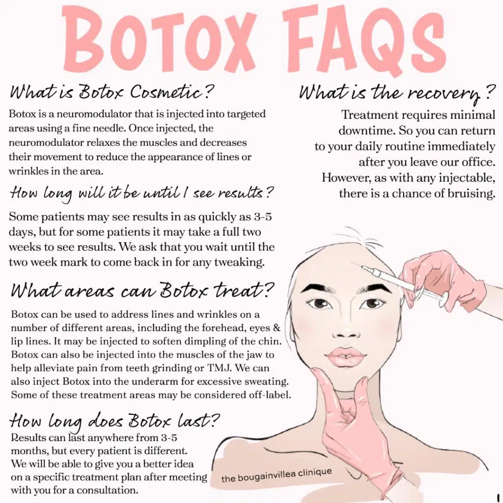 botox faqs